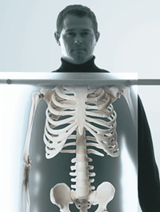 Rather than lying down, we want X-ray views showing your body in a weight-bearing position.